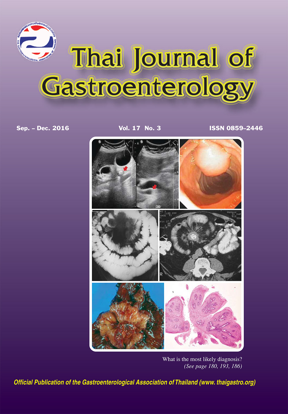 file/Thai-Journal-of-gastroenterology-images3428495.jpg
